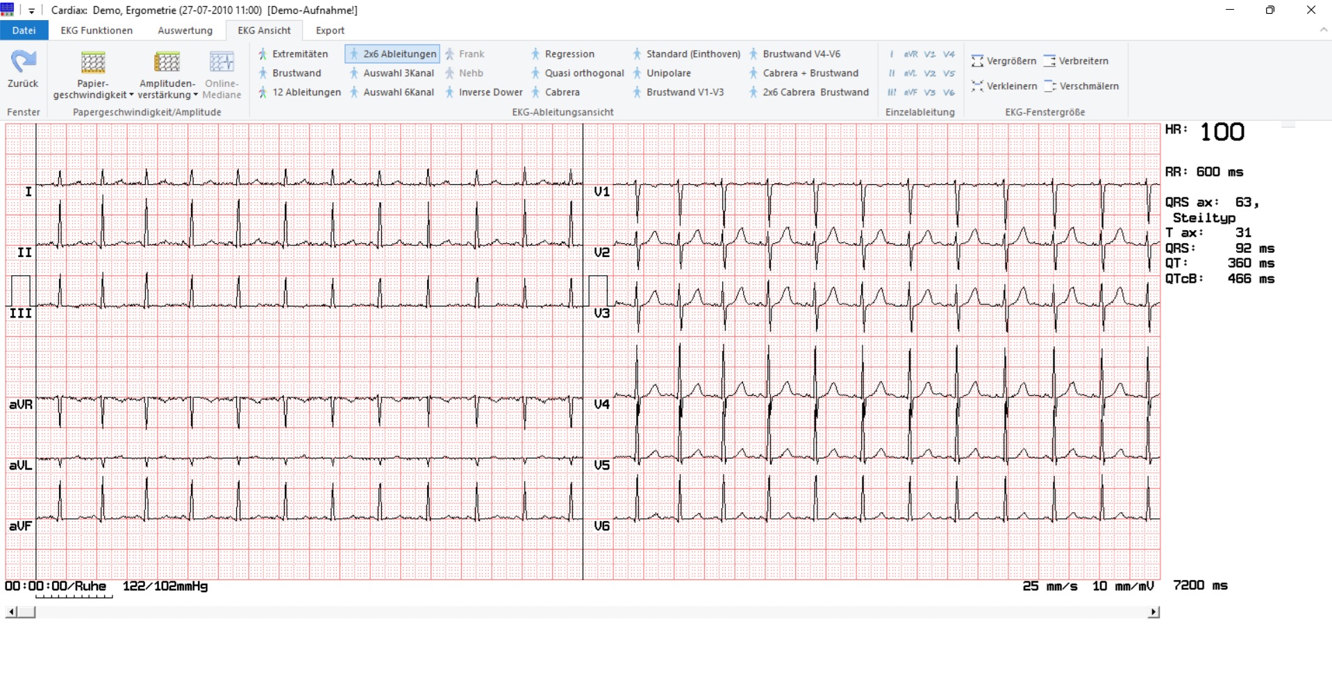 CARDIAX® Ruhe- und Belastungs-EKG von MESA Medizintechnik – Bild 2