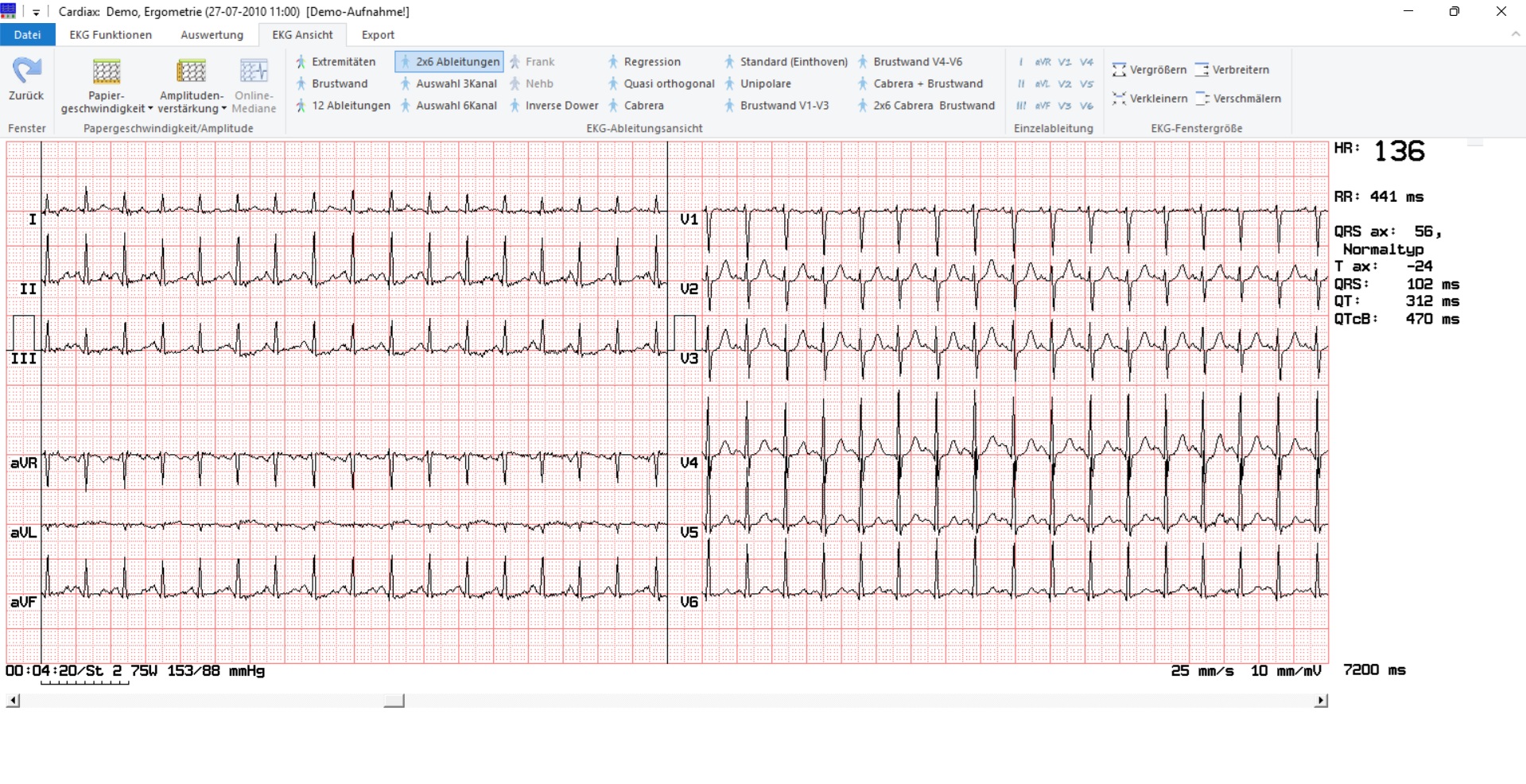 CARDIAX® Ruhe- und Belastungs-EKG von MESA Medizintechnik – Bild 3