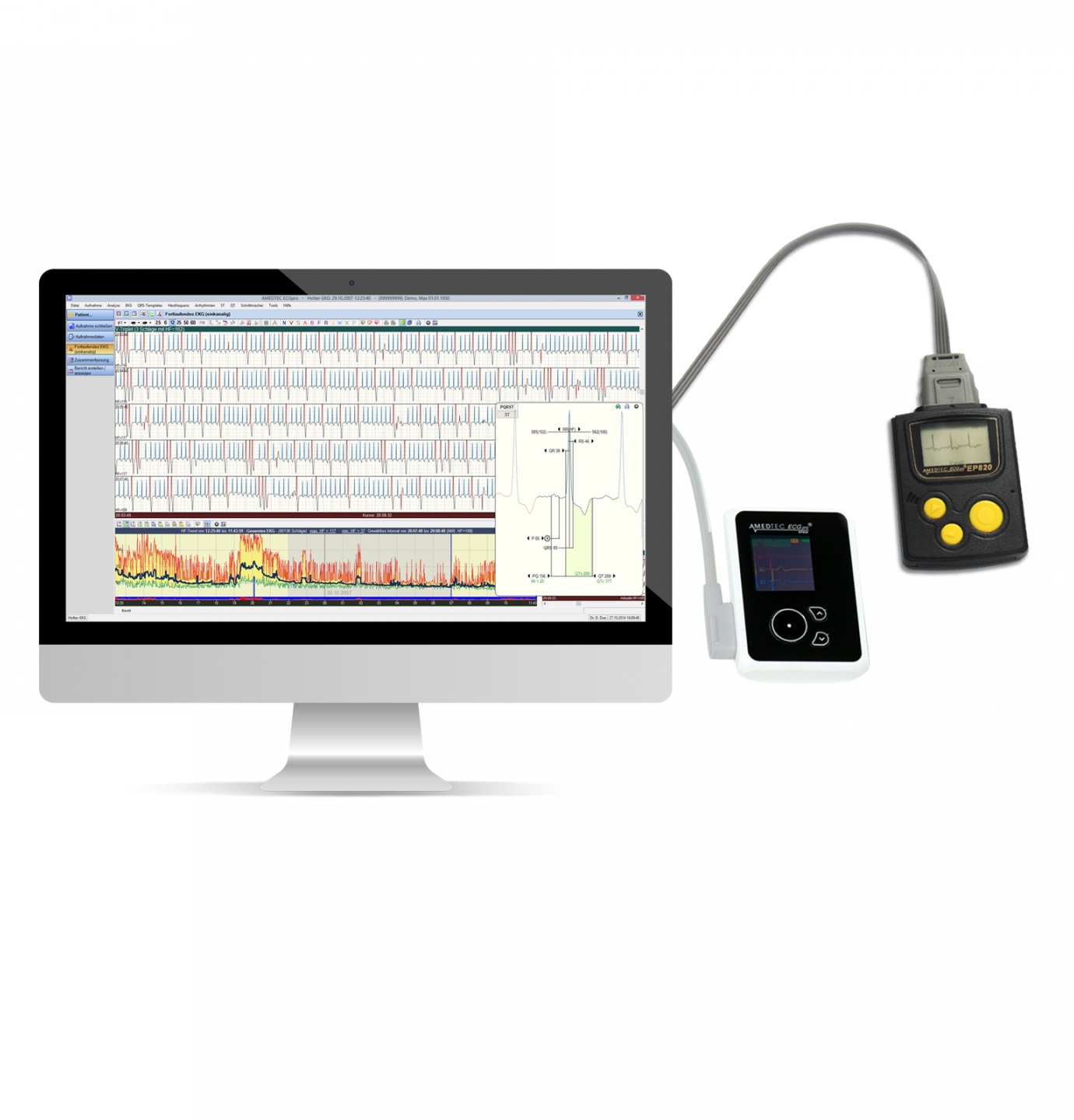 EP830 Langzeit-EKG mit Analysesoftware von AMEDTEC – Bild 2