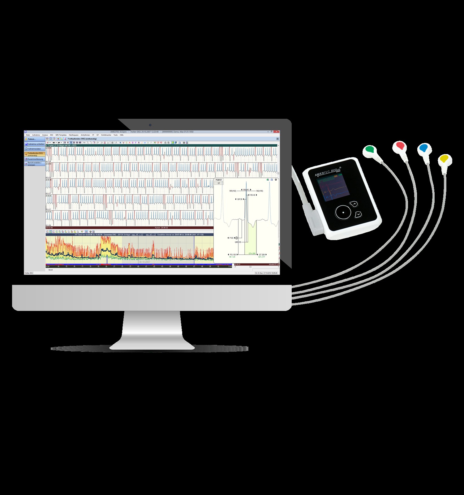 EP830 Langzeit-EKG mit Analysesoftware von AMEDTEC